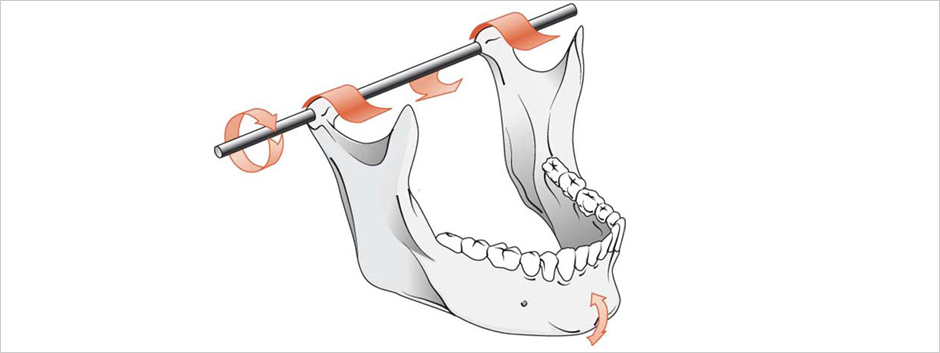 Temporomandibular Joint Dysfunction Treatment - Dental Trends